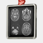 MRI-scan van Brain Metalen Ornament (Links)