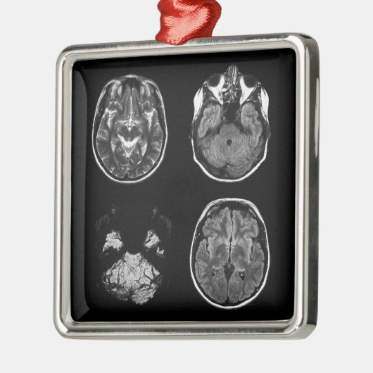 MRI-scan van Brain Metalen Ornament (Links)