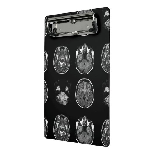 MRI-scan van Brain Mini Klembord (Angled2)