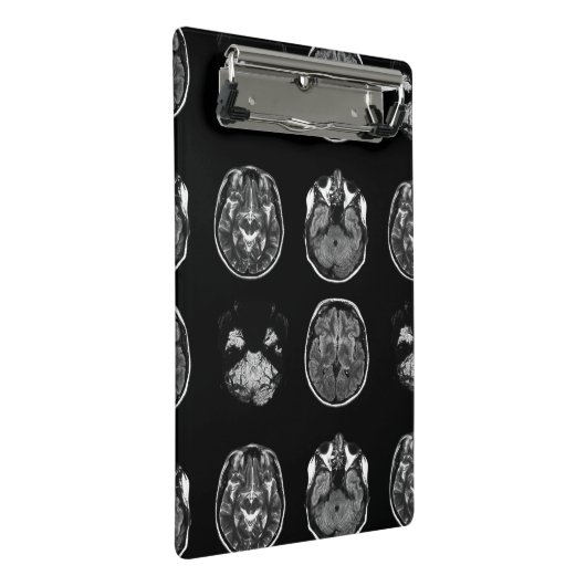 MRI-scan van Brain Mini Klembord (Schuin)