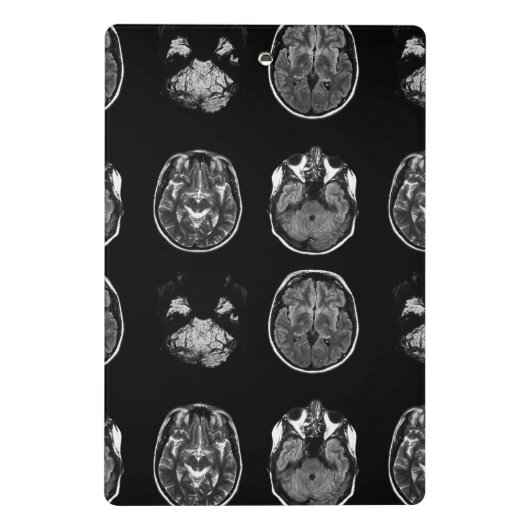 MRI-scan van Brain Mini Klembord (Achterkant)
