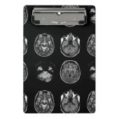 MRI-scan van Brain Mini Klembord (Voorkant)