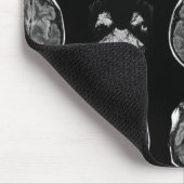 MRI-scan van Brain Muismat (Hoek)