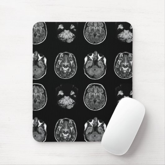 MRI-scan van Brain Muismat (Met muis)
