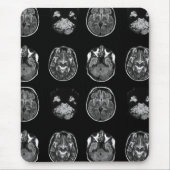 MRI-scan van Brain Muismat (Voorkant)