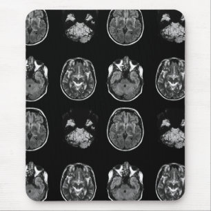 MRI-scan van Brain Muismat