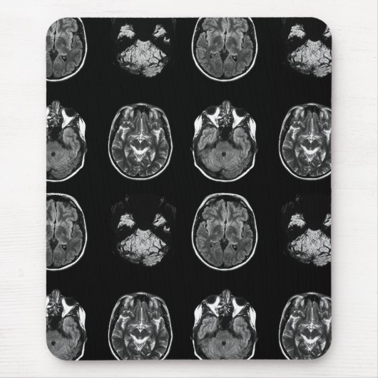 MRI-scan van Brain Muismat (Voorkant)