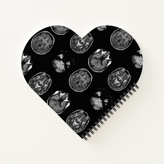 MRI-scan van Brain Notitieboek (Achterkant)