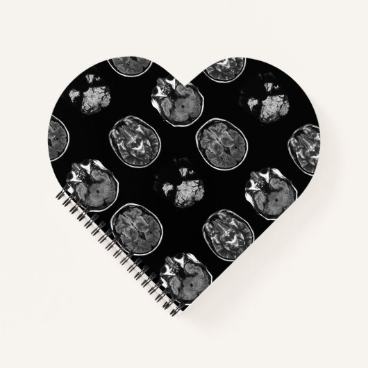 MRI-scan van Brain Notitieboek (Voorkant)