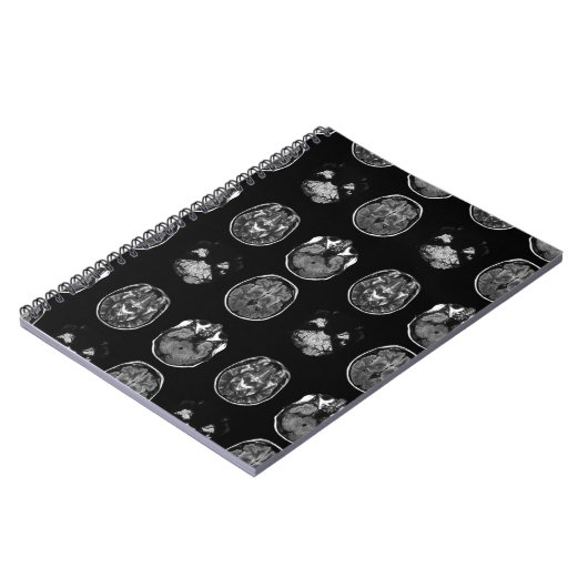 MRI-scan van Brain Notitieboek (Linkerzijde)