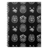 MRI-scan van Brain Notitieboek (Voorkant)