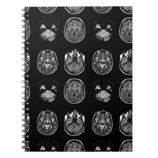 MRI-scan van Brain Notitieboek (Voorkant)