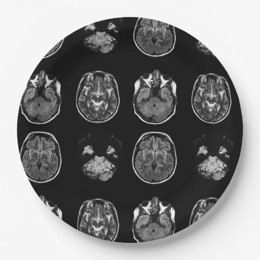 MRI-scan van Brain Papieren Bordje (Voorkant)