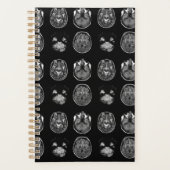 MRI-scan van Brain Planner (Voorkant)