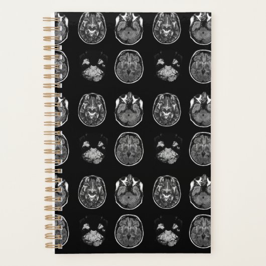 MRI-scan van Brain Planner (Voorkant)