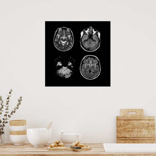 MRI-scan van Brain Poster (Keuken)