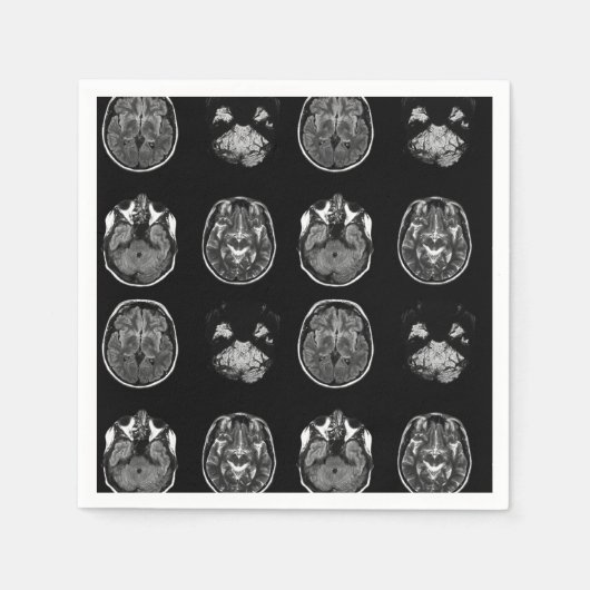 MRI-scan van Brain Servet (Voorkant)