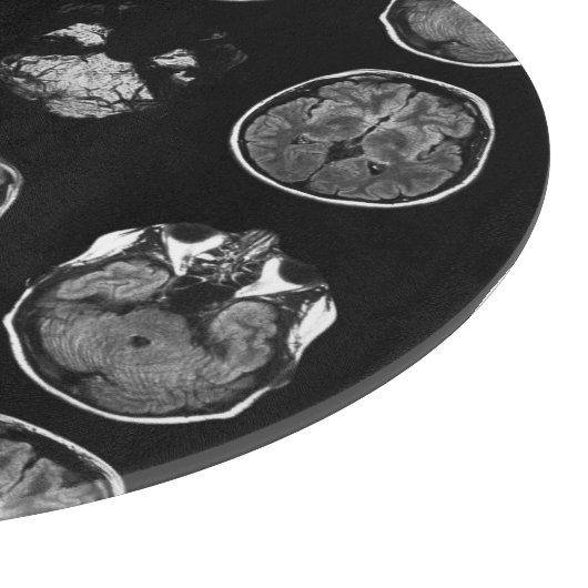 MRI-scan van Brain Snijplank (Hoek)