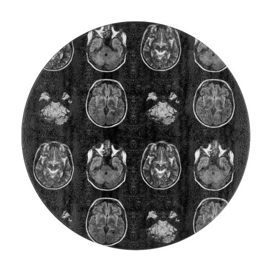 MRI-scan van Brain Snijplank (Voorkant)