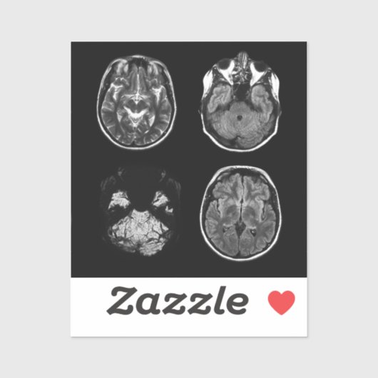 MRI-scan van Brain Sticker (Vel)