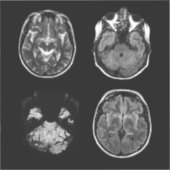 MRI-scan van Brain Sticker (Voorkant)