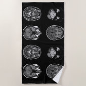 MRI-scan van Brain Strandlaken (Voorkant)