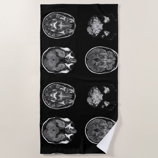 MRI-scan van Brain Strandlaken (Voorkant)