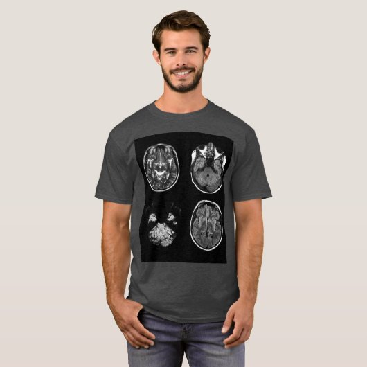 MRI-scan van Brain T-shirt (Voorkant volledig)