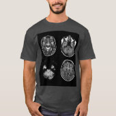 MRI-scan van Brain T-shirt (Voorkant)