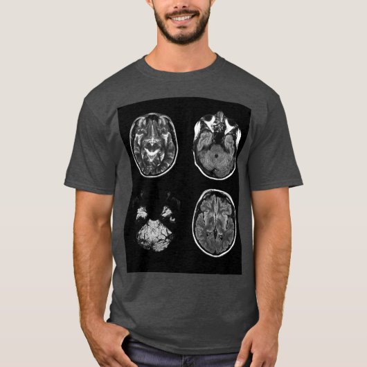 MRI-scan van Brain T-shirt (Voorkant)