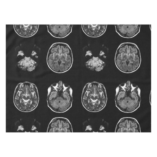 MRI-scan van Brain Tafelkleed (Voorkant (Horizontaal))