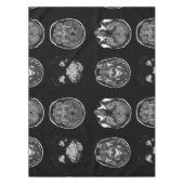 MRI-scan van Brain Tafelkleed (Voorkant)