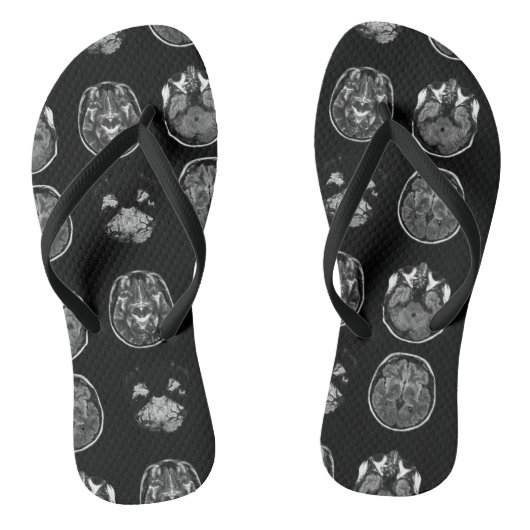 MRI-scan van Brain Teenslippers (Voetbed)