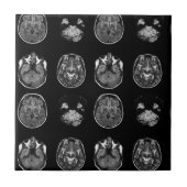 MRI-scan van Brain Tegeltje (Voorkant)
