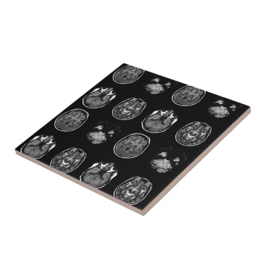 MRI-scan van Brain Tegeltje (Zijkant)