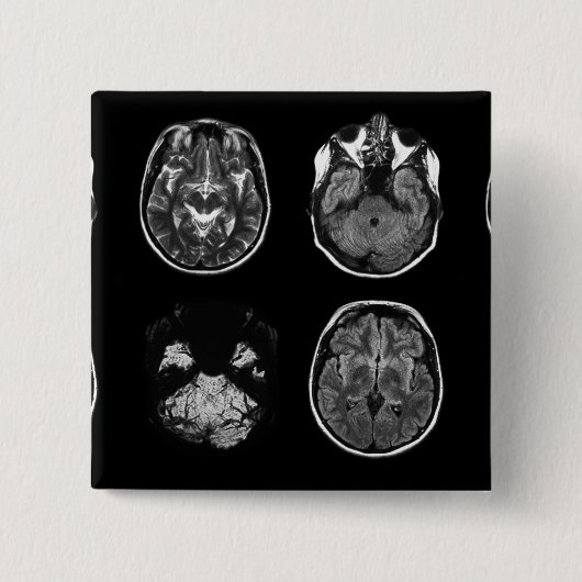 MRI-scan van Brain Vierkante Button 5,1 Cm (Voorkant)
