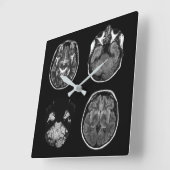 MRI-scan van Brain Vierkante Klok (Hoek)