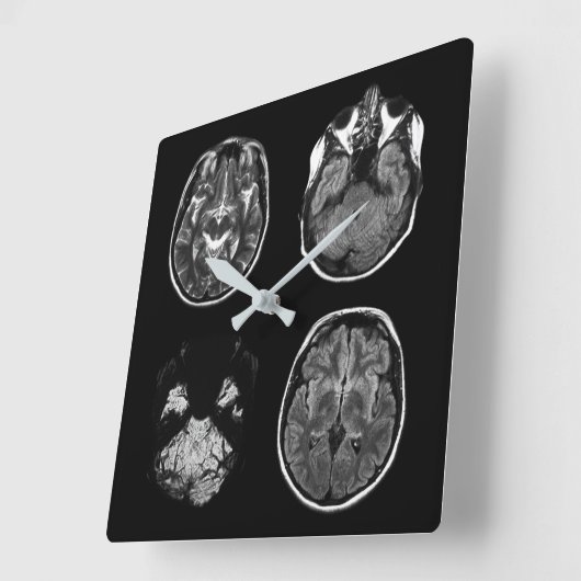 MRI-scan van Brain Vierkante Klok (Hoek)