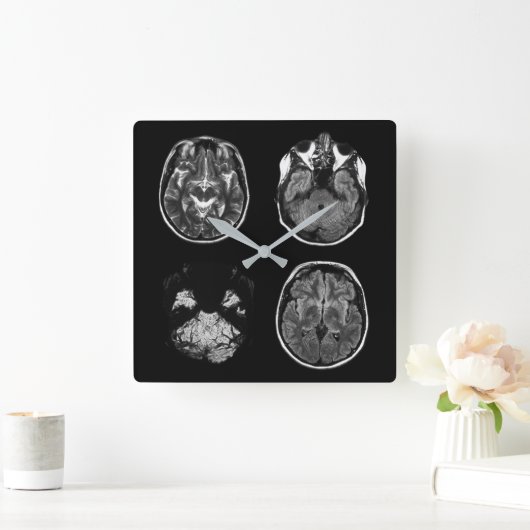 MRI-scan van Brain Vierkante Klok (Huis)