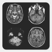 MRI-scan van Brain Vierkante Sticker (Voorkant)