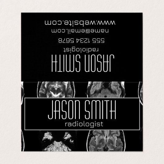 MRI-scan van Brain Visitekaartje (Buitenkant ongevouwen)