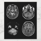 MRI-scan van Brain Wijn Etiket (Enkel label)