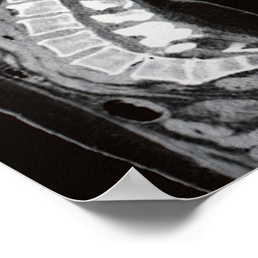 MRI van de wervelkolom Poster (Hoek)