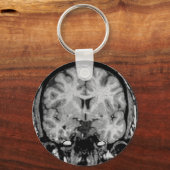 MRI voor brein, coronaal segment Sleutelhanger (Voorkant)