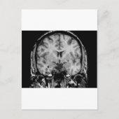 MRI voor hersenen, coronaal segment Briefkaart (Voorkant)