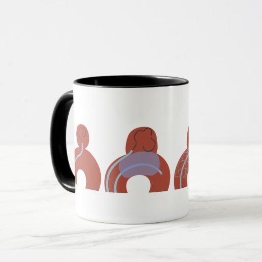 Mug de Aneurismas Mok (Voorkant links)