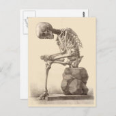 My Feet Are Killing Me Briefkaart (Voorkant / Achterkant)