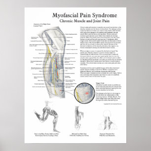 Myofasciale pijn Syndroom Poster