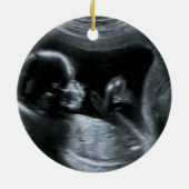 Naar verwachting Sonogram kerstboom en Wieg Keramisch Ornament (Achterkant)