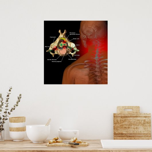 Necchpijn Poster (Keuken)